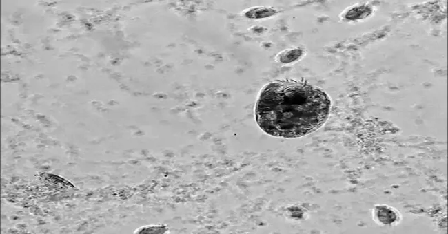 This microbe turns into a cannibalistic ‘Hulk’